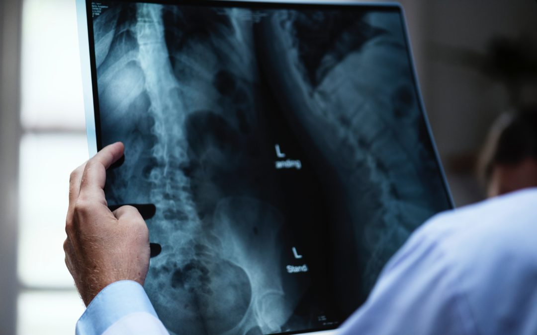 a man looking at an X-ray result at a best motor vehicle attorney